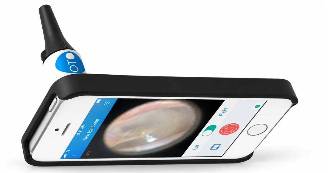 CellScope Oto Smartphone Otoscope (Discontinued)