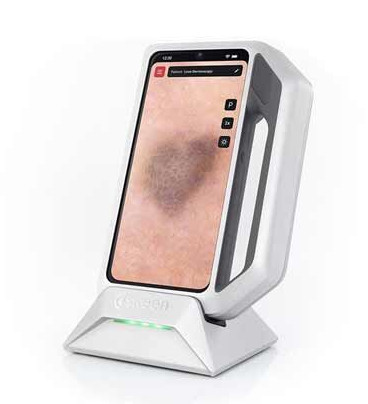 DERMATOSCOPE WITH AI BUILT IN 1 FOTOFINDER DERMATOSCOPE AI BUILT IN
