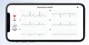 ECG WITH AI 2 KardiaMobile® 6L