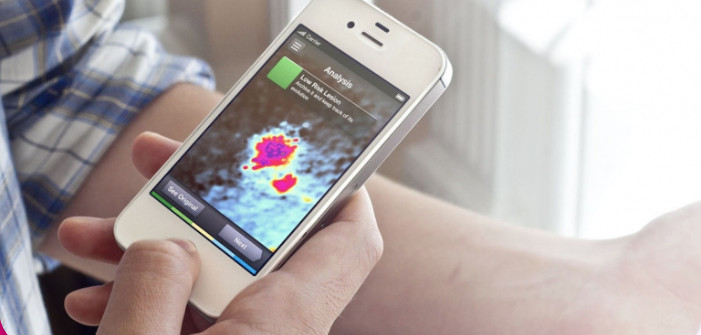 DERMATOSCOPE WITH AI BUILT IN 3 SKINVISION DERMATOSCOPE WITH AI