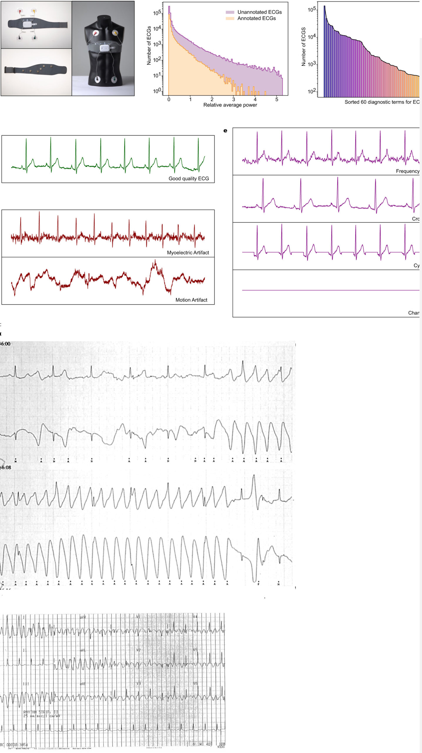 10 CRITICAL MISTAKES IN MEDICAL DEVICE AI BUILT THAT COULD BE AVOIDED WITH CLOUD-BASED AI SOLUTIONS 7 FAULTY ECG INTERPRETATION LEADING TO FALSE ALARMS