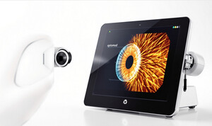 OPTOMED SMARTSCOPE PRO FUNDUS CAMERA